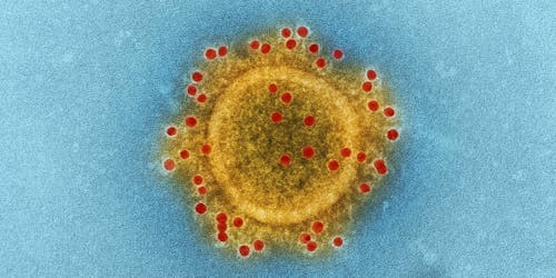 A magnified image of a virus