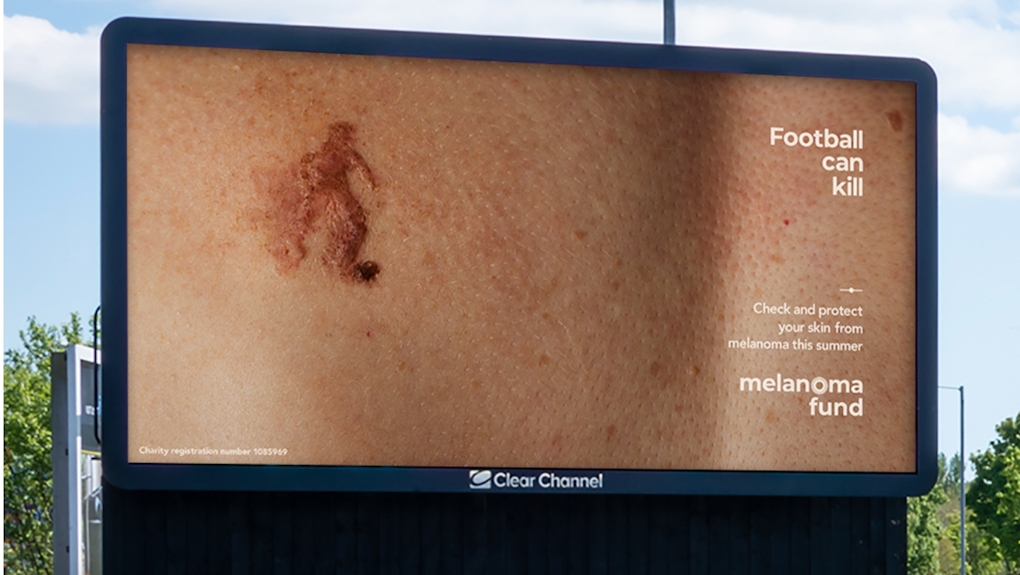 The Melanoma Fund Silhouettes billboard 